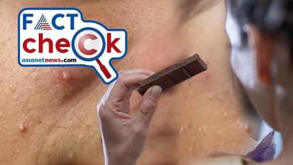 ചോക്ക്ലേറ്റ് അധികം കഴിക്കല്ലേ, മുഖക്കുരു വരും; സത്യമെന്ത്?