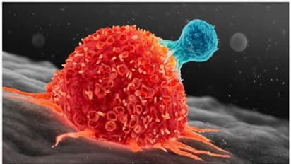 കാൻസർ ഉണ്ടാകുന്നതിന് പിന്നിലെ 10 പ്രധാനപ്പെട്ട കാരണങ്ങൾ 