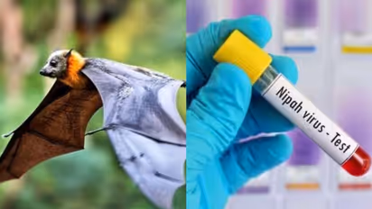 “ 48 மணி நேரத்தில் கோமா நிலை கூட ஏற்படலாம்..” நிபா வைரஸின் 3 ஆபத்து காரணிகள் என்னென்ன தெரியுமா?