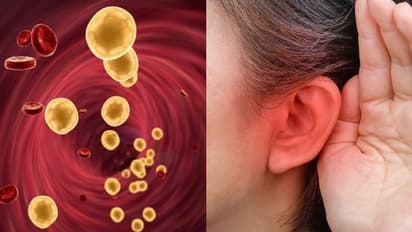 ഉയർന്ന കൊളസ്ട്രോൾ ചെവിയെ ബാധിക്കുന്നത് ഇങ്ങനെ; അറിയാം ഈ ലക്ഷണങ്ങള്‍...