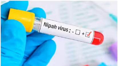 കേരളത്തില്‍ നിന്ന് ബംഗാളിലെത്തിയ അതിഥി തൊഴിലാളിയുടെ നിപ ഫലം നെഗറ്റീവ്