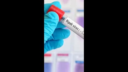 Nipah Virus: వారం రోజుల పాటు విద్యాసంస్థలకు సెలవులు..