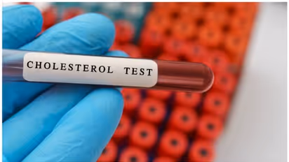 ഉയർന്ന കൊളസ്ട്രോൾ നിയന്ത്രിക്കാൻ സഹായിക്കുന്ന ആറ് സൂപ്പർ ഫുഡുകൾ