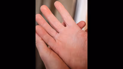 உங்கள் உள்ளங்கை அடிக்கடி வியர்க்குதா..? ஜாக்கிரதை... இது ஒரு கொடிய நோயின் அறிகுறி!