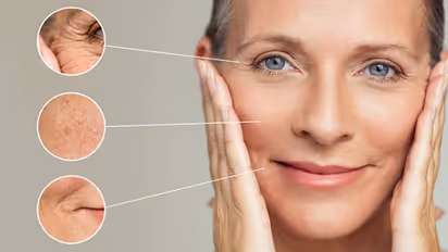 ചര്‍മ്മം കണ്ടാല്‍ പ്രായം തോന്നിക്കുന്നുണ്ടോ?  പരീക്ഷിക്കാം ഈ നാല് ഫേസ് പാക്കുകള്‍...