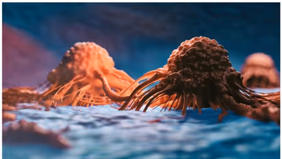 പുകവലിക്കാത്തവരിൽ ശ്വാസകോശ കാൻസർ ഉണ്ടാകുന്നതിന് പിന്നിലെ 5 കാരണങ്ങൾ