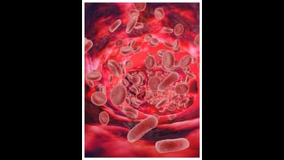 വിളർച്ച അകറ്റാൻ ഭക്ഷണത്തിൽ ശ്രദ്ധിക്കേണ്ടത് എന്തൊക്കെ?