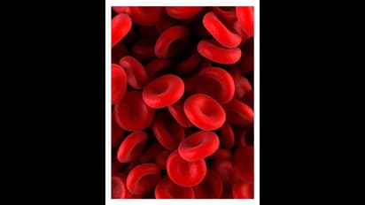 இயற்கையாகவே ஹீமோகுளோபின் அளவை அதிகரிக்கலாம்.. இந்த 5 உணவுகளை சாப்பிட்டால் போதும்.. 