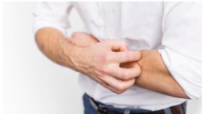 Health Tips : ഫാറ്റി ലിവർ രോഗം ; ചർമ്മത്തിൽ കാണുന്ന ചില ലക്ഷണങ്ങൾ