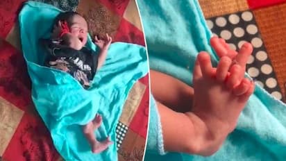 26 ಬೆರಳುಗಳಿರುವ ಹೆಣ್ಣು ಮಗು ಜನನ: ಲಕ್ಷ್ಮಿಯ ಪ್ರತಿರೂಪವೆಂದ ಕುಟುಂಬ