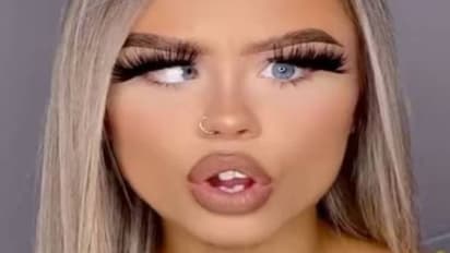 കോങ്കണ്ണുള്ള മോഡൽ കണ്ണുകൾ ഉപയോഗിച്ച് സമ്പാദിച്ചത് മൂന്നുകോടി; ശസ്ത്രക്രിയയിലൂടെ കണ്ണുകൾ നേരെയാക്കാൻ ശ്രമം