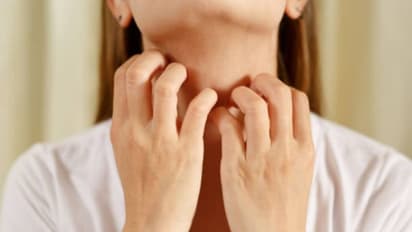 സ്ത്രീകളില് മുഖത്ത് അമിത രോമവളര്ച്ച; അറിഞ്ഞിരിക്കേണ്ട ലക്ഷണങ്ങള്...