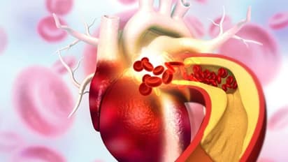 മാനസിക സമ്മര്ദ്ദം ചീത്ത കൊളസ്ട്രോളിന്റെ അളവ് കൂട്ടുമോ? ന്യൂട്രീഷ്യനിസ്റ്റ് പറയുന്നു...
