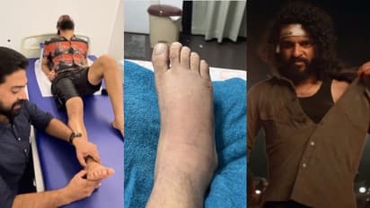 ഇതാണ് ഡെഡിക്കേഷൻ..; നീരും കഠിനമായ വേദനയും, ആ കാലും വച്ച് 'സേവ്യർ' നിറഞ്ഞാടി