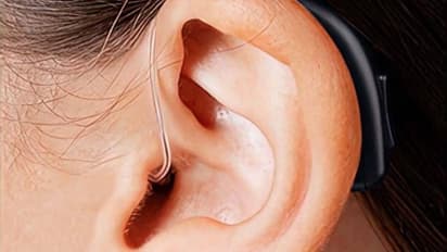 പ്രവർത്തിക്കാത്ത കേൾവി സഹായി തിരിച്ചുവാങ്ങി, പണം മടക്കിനൽകിയില്ല; മുക്കാൽ ലക്ഷം പിഴ വിധിച്ച് കോടതി