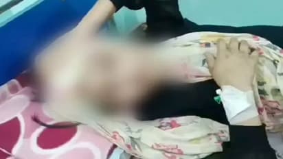 दांत टूटे-जीभ पर घाव-चेहरे पर जले के निशान, डस्टबिन से खाना, 6 महीने तक ऐसी दरिंदगी की सुनकर कांप उठा हर शख्स