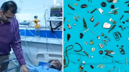 കടുത്ത വയറുവേദന; ഒടുവില്‍ ശസ്ത്രക്രിയയിലൂടെ വയറ്റിനുള്ളില്‍ നിന്ന് പുറത്തെടുത്തത് കണ്ടോ