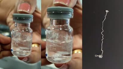 തടിപ്പും ചുവപ്പും വേദനയും, ആലുവയിൽ 39കാരിയുടെ കണ്ണില് നിന്ന് ജീവനോടെ പുറത്തെടുത്തത് 15 സെ.മീ. നീളമുള്ള വിര!