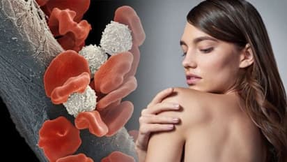 ബ്ലഡ് ക്യാൻസർ; ഈ പത്ത് പ്രാരംഭ ലക്ഷണങ്ങളെ നിസാരമാക്കരുത്...