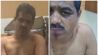 മര്‍ദ്ദിച്ചെന്ന് പരാതി നല്‍കി ഭാര്യ;  അന്വേഷിക്കാനെത്തിയ പൊലീസുകാരെ വടി കൊണ്ട് ആക്രമിച്ച് പ്രതി