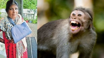 നിലമ്പൂരിൽ വീട്ടുമുറ്റത്ത് ജോലി ചെയ്യുന്നതിനിടെ വീട്ടമ്മയുടെ കൈ തേങ്ങ പറിച്ചെറിഞ്ഞൊടിച്ച് കുരങ്ങ് 