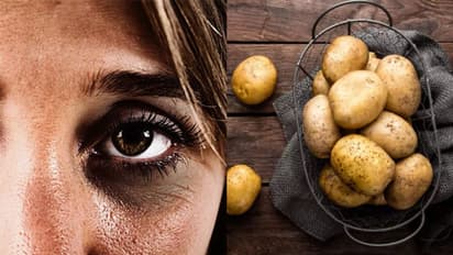 കണ്ണിന് ചുറ്റുമുള്ള കറുത്ത പാടുകള്‍ മാറ്റാന്‍ ഉരുളക്കിഴങ്ങ് ഇങ്ങനെ ഉപയോഗിക്കൂ... 