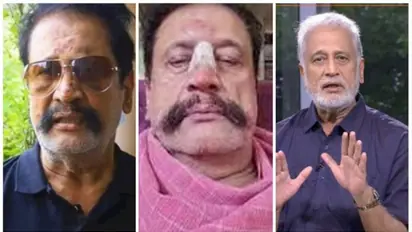 അടിച്ച് മുഖം പൊളിച്ചു, ആസിഡ് ആക്രമണത്തിന് ശ്രമിച്ചു: ക്രൂരമായ ആക്രമണത്തെക്കുറിച്ച് നടന് മോഹന് ശര്മ്മ