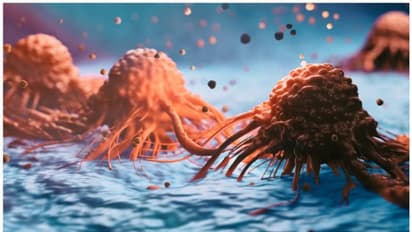 പ്രോസ്റ്റേറ്റ് കാൻസറിന്റെ ലക്ഷണങ്ങൾ എന്തൊക്കെ? എങ്ങനെ പ്രതിരോധിക്കാം?