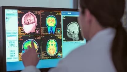 കൊവിഡിന് പിന്നാലെ തലച്ചോര് ബാധിക്കപ്പെട്ട് മരണം; കാണിച്ചത് മറവിരോഗത്തിന്റെ ലക്ഷണങ്ങള്...