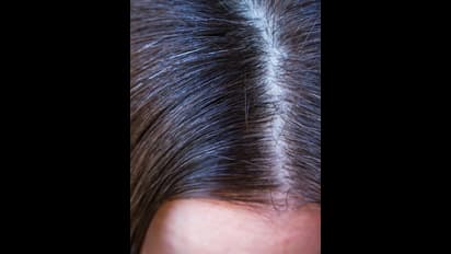 Parenting Tips : உங்க குழந்தைக்கு முடி நரைக்குதா ..? அப்போ இதை ஃபாலோ பண்ணுங்க..!