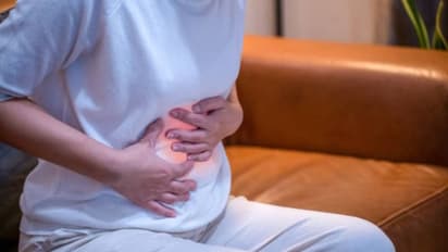 വെളുക്കാൻ ക്രീം തേച്ച് വൃക്കരോഗം; എന്താണ് 'നെഫ്രോട്ടിക് സിൻഡ്രോം'?