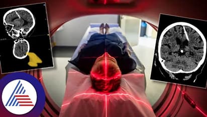 ಮೆದುಳಲ್ಲಿ ಸೂಜಿ ಇಟ್ಕೊಂಡೇ 80 ವರ್ಷ ಬದುಕಿದ್ದಾಳಂತೆ ಈ ಮಹಿಳೆ!