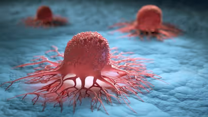 ആറ് മാസം കൊണ്ട് ക്യാൻസര് മുഴുവനായി മാറി; ഇത് അത്ഭുതമരുന്നോ എന്ന് ഏവരിലും ആശ്ചര്യം...