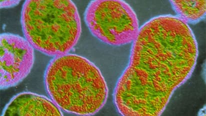 എന്താണ് ബ്രൂസല്ലോസിസ് രോഗം? പകരുന്നതെങ്ങനെ? പാൽ ഉപയോഗത്തിലടക്കം ശ്രദ്ധവേണം! ജാഗ്രതാ നിർദേശങ്ങൾ ഇങ്ങനെ...