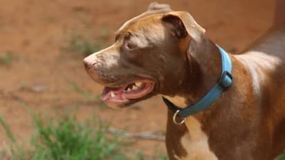 വീട്ട് മുറ്റത്ത് നില്‍ക്കുമ്പോൾ അയൽവാസിയുടെ പിറ്റ്ബുൾ ആക്രമിച്ചു; 76 കാരിയുടെ മുഖത്തിന്‍റെ പാതി കടിച്ച് കീറി