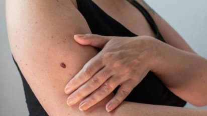 ചര്‍മ്മത്തിലും തലയോട്ടിയിലും കാണുന്ന ഈ സൂചനകളെ നിസാരമായി കാണരുത്...