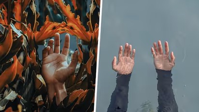 Sweaty palms no more: 7 effective ways to manage excessive hand perspiration