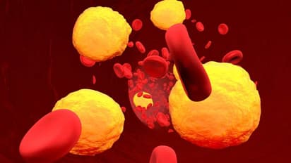 കൊളസ്ട്രോള് കുറയ്ക്കാന് ദിവസവും ഈ ഒരൊറ്റ ഫ്രൂട്ട് കഴിക്കൂ; അറിയാം ഗുണങ്ങള്...