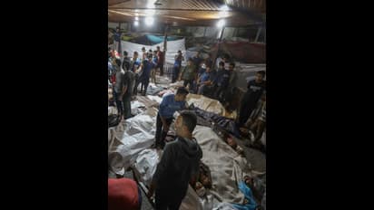 ಗಾಜಾದಲ್ಲಿ ಅನಸ್ತೇಶಿಯಾ ಇಲ್ಲದೇ ಶಸ್ತ್ರಚಿಕಿತ್ಸೆ:  ಗಾಯಾಳುಗಳ ಉಳಿಸಲು ವೈದ್ಯರ ಹರಸಾಹಸ