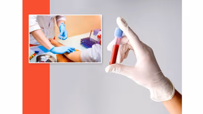 ಭಾರತದಲ್ಲಿ ಹೆಚ್ಚುತ್ತಿರುವ ಅಪರೂಪದ ಕಾಯಿಲೆಗಳ ಬಗ್ಗೆ ನೀವು ಇವತ್ತೇ ತಿಳಿದುಕೊಳ್ಳಬೇಕು!