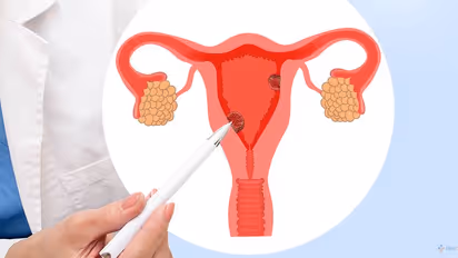എൻഡോമെട്രിയൽ കാൻസർ ; അറിയാം മൂന്ന് പ്രധാനപ്പെട്ട ലക്ഷണങ്ങൾ
