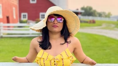 दो हाथ गंवाए, 2 साल बिस्तर पर रही- फिर बन गई दुनिया की बड़ी मोटिवेशनल स्पीकर