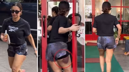 Watch: Malaika Arora spotted with dark black bruise on her thighs; leaving fans worried
