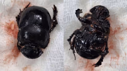 8മാസം പ്രായമുള്ള കുഞ്ഞിന് ശ്വാസതടസ്സം, കാരണമറിയാതെ വീട്ടുകാർ, തൊണ്ടയില് കുടുങ്ങിയത് കൊമ്പന് ചെല്ലി വണ്ട്!