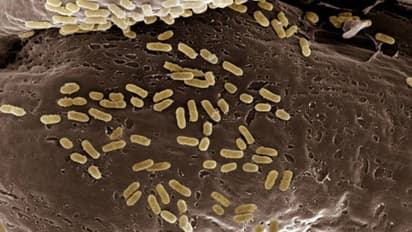 ഭക്ഷ്യവിഷബാധ ഉണ്ടാകുന്നത് നമുക്ക് എങ്ങനെയെല്ലാം തടയാം?