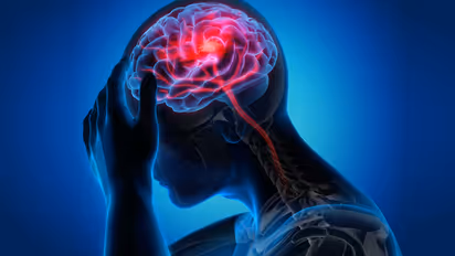 World Stroke Day 2023