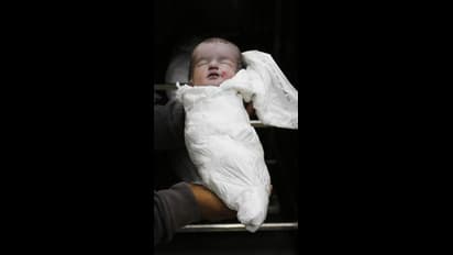 ಹುಟ್ಟಿದ 5ನೇ ದಿನಕ್ಕೆ ಮಗುವಿಗೆ ಋತುಸ್ರಾವ…. ಏನಿದು ಸಮಸ್ಯೆ ತಿಳಿಯಿರಿ 