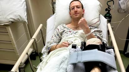 'ആശാന് എന്തുപറ്റി?'; മാര്‍ക്ക് സക്കര്‍ബര്‍ഗിന്‍റെ ആശുപത്രി ഫോട്ടോ വൈറലാകുന്നു...