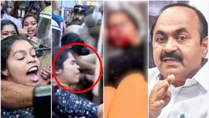 ക്രൂരം, മുക്കിനിടിയേറ്റ പെൺകുട്ടിക്ക് സർജറി വേണം; 'ഇവനൊക്കെ മക്കളില്ലേ', നടപടി വേണമെന്നും പ്രതിപക്ഷ നേതാവ്