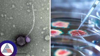 ಅಮೇರಿಕಾದಲ್ಲಿ ಡೇಂಜರಸ್ ವಾಂಪೈರ್ ವೈರಸ್ ಪತ್ತೆ; ಇದ್ರಿಂದ ತಿನ್ನೋಕೆ ಆಹಾರಾನೇ ಸಿಗದಂತೆ ಆಗ್ಬೋದು!